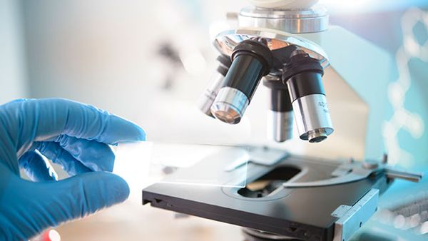Microscopie onderzoek